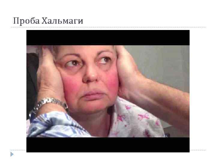 Проба Хальмаги 