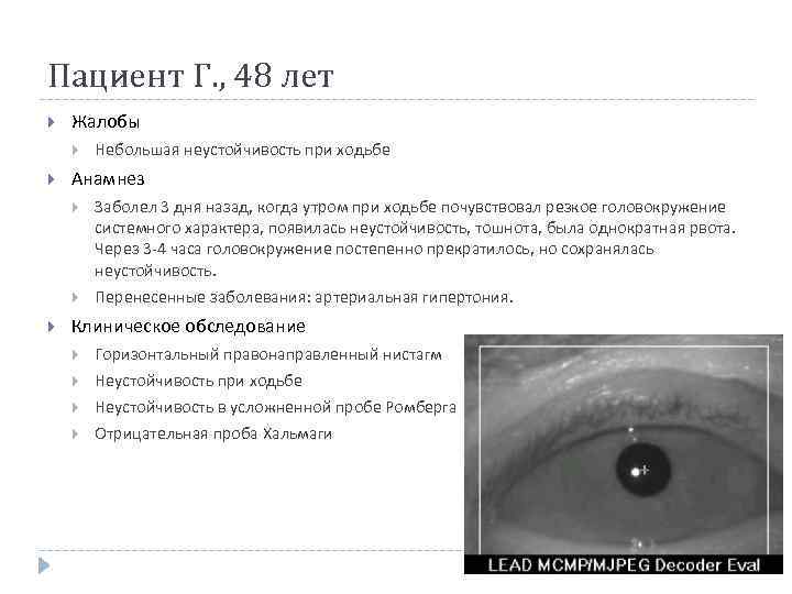 Пациент Г. , 48 лет Жалобы Небольшая неустойчивость при ходьбе Анамнез Заболел 3 дня