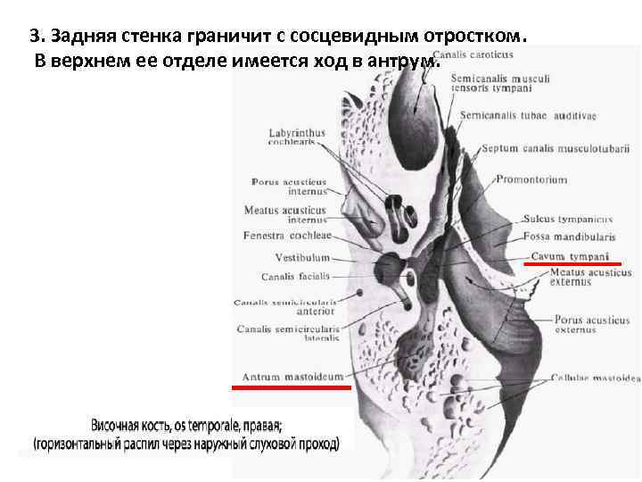 3. Задняя стенка граничит с сосцевидным отростком. В верхнем ее отделе имеется ход в