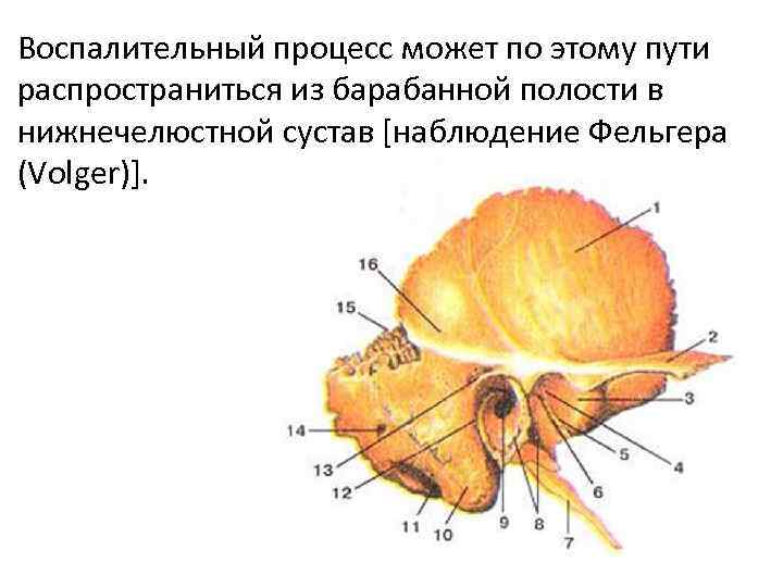 Воспалительный процесс может по этому пути распространиться из барабанной полости в нижнечелюстной сустав [наблюдение