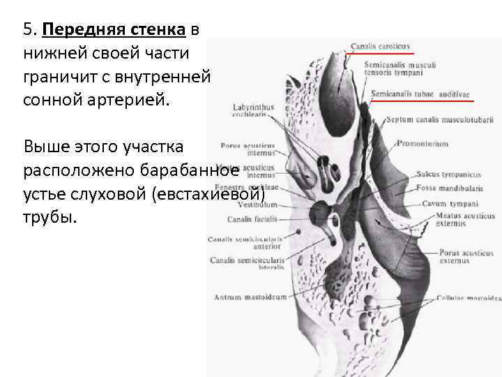 5. Передняя стенка в нижней своей части граничит с внутренней сонной артерией. Выше этого