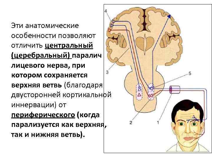 Эти анатомические особенности позволяют отличить центральный (церебральный) паралич лицевого нерва, при котором сохраняется верхняя