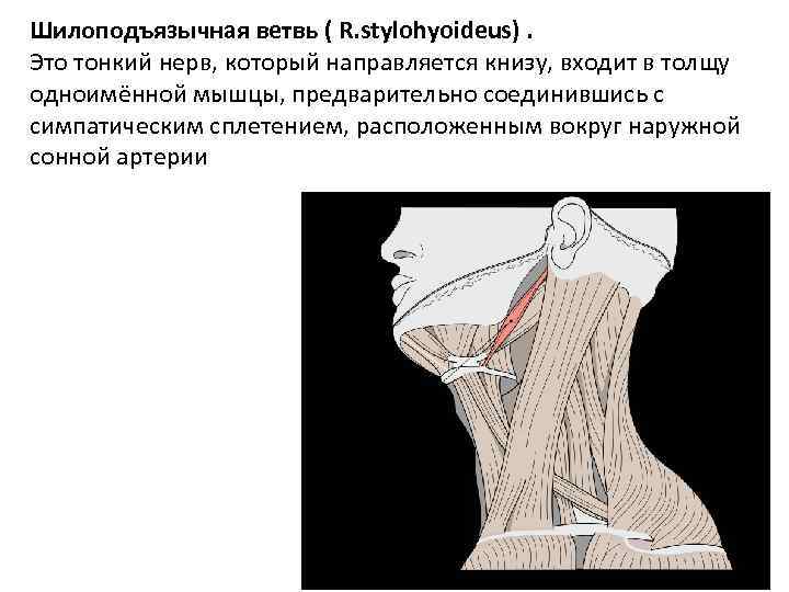 Шилоподъязычный синдром фото