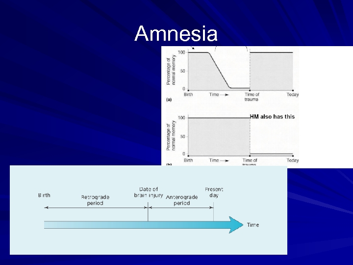 Amnesia Types of amnesia – Anterograde – Retrograde 