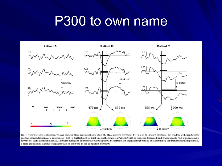 P 300 to own name 