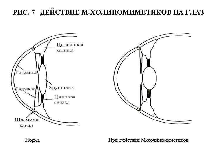 Капли для снятия аккомодации