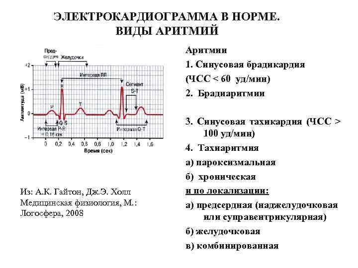 Синусовая брадикардия карта вызова