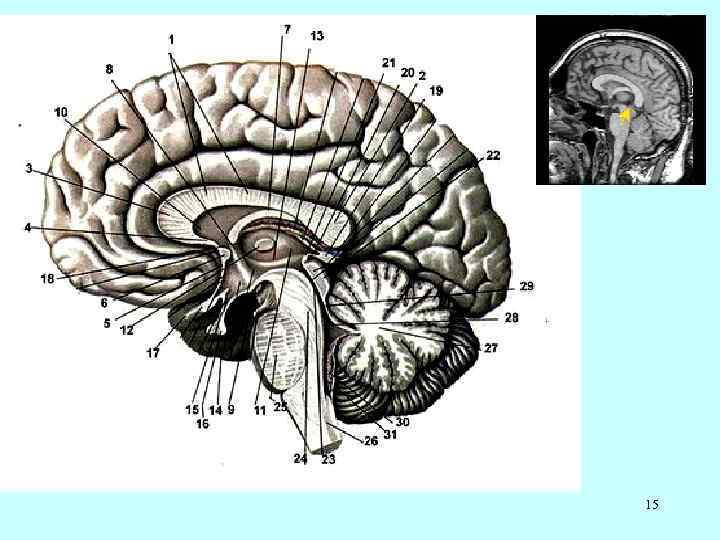 Строение мозолистого тела головного мозга. Мозолистое тело Corpus callosum. Строение мозолистого тела головного мозга анатомия. Мозолистое тело мозга строение. Правильная последовательность расположения отделов ствола головного мозга