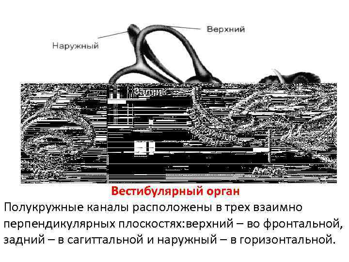 Вестибулярный орган Полукружные каналы расположены в трех взаимно перпендикулярных плоскостях: верхний – во фронтальной,