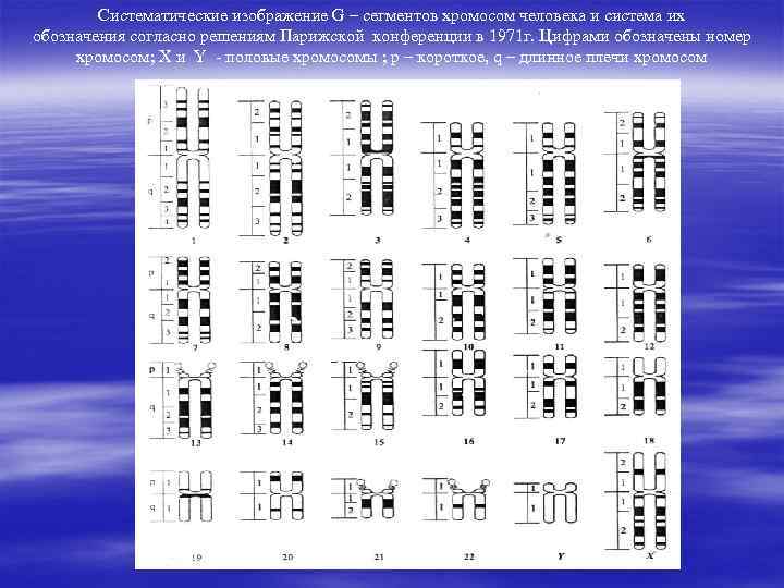 Систематические изображение G – сегментов хромосом человека и система их обозначения согласно решениям Парижской