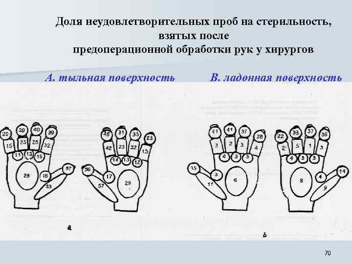 Доля неудовлетворительных проб на стерильность, взятых после предоперационной обработки рук у хирургов А. тыльная