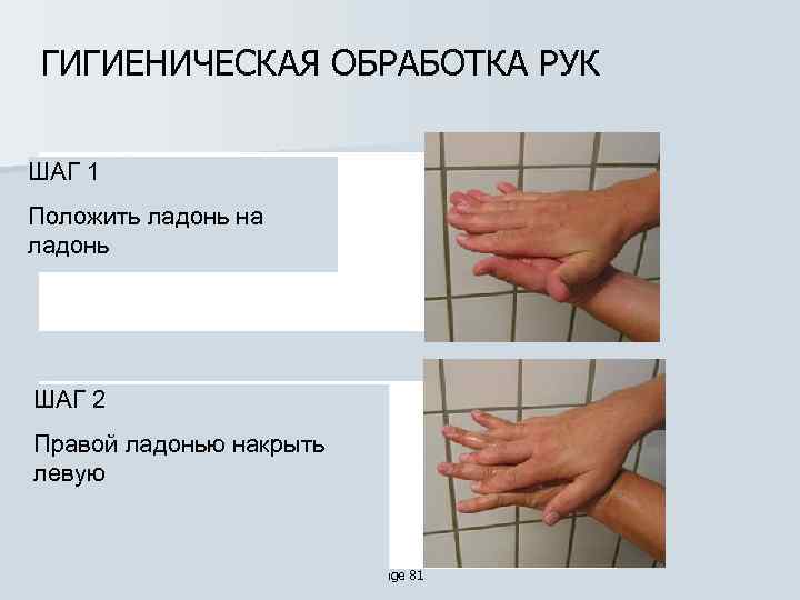 ГИГИЕНИЧЕСКАЯ ОБРАБОТКА РУК ШАГ 1 Положить ладонь на ладонь ШАГ 2 Правой ладонью накрыть