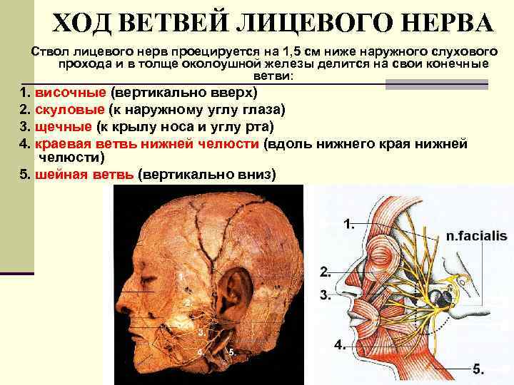 ХОД ВЕТВЕЙ ЛИЦЕВОГО НЕРВА Ствол лицевого нерв проецируется на 1, 5 см ниже наружного