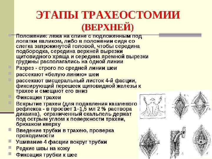 Топография головы и шеи 