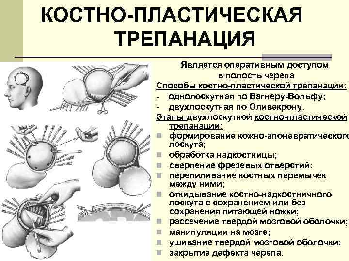 КОСТНО-ПЛАСТИЧЕСКАЯ ТРЕПАНАЦИЯ Является оперативным доступом в полость черепа Способы костно-пластической трепанации: - однолоскутная по