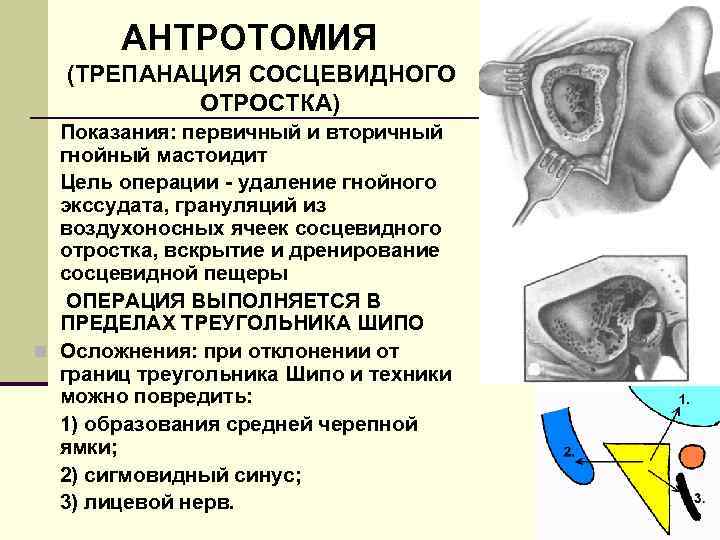 Сосцевидный отросток картинка