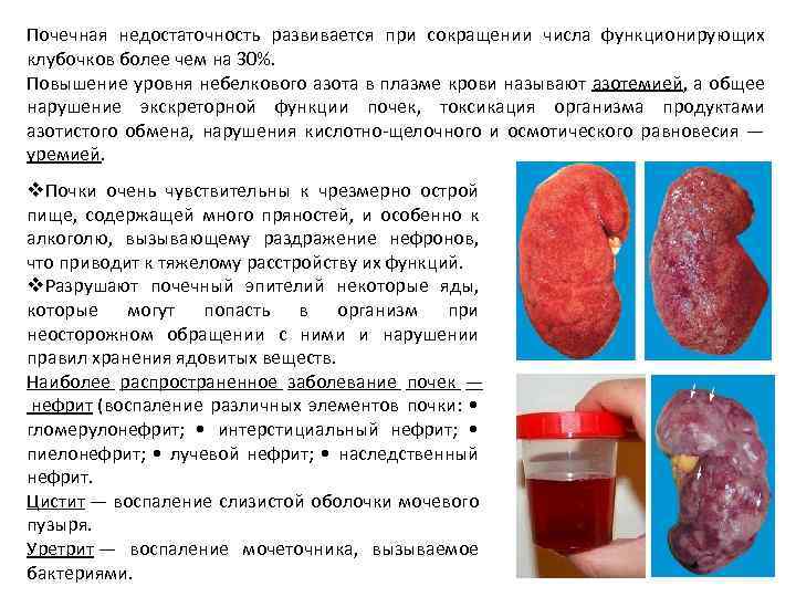 Почечная недостаточность развивается при сокращении числа функционирующих клубочков более чем на 30%. Повышение уровня