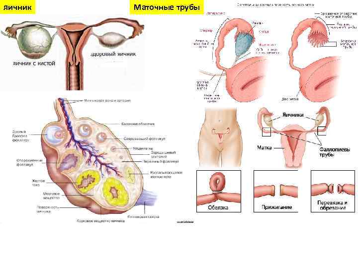 яичник Маточные трубы 