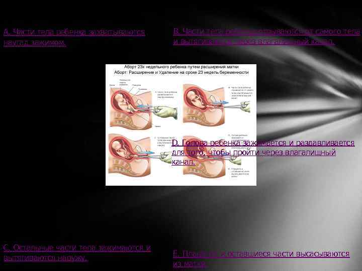 А. Части тела ребенка захватываются наугад зажимом. В. Части тела ребенка отрываются от самого