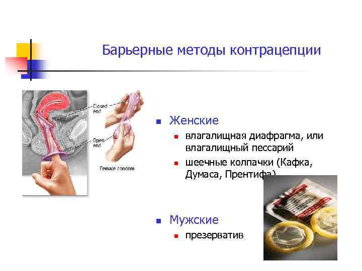 Барьерный способ. Презервативы метод контрацепции. Барьерные методы контрацепции. Барьерные механические контрацептивы. Механические контрацептивы для женщин.