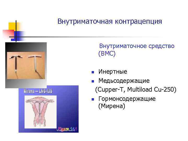 Внутриматочная контрацепция Внутриматочное средство (ВМС) Инертные n Медьсодержащие (Cupper-T, Multiload Cu-250) n Гормонсодержащие (Мирена)