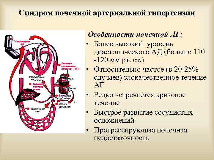 Синдром почечной артериальной гипертензии Особенности почечной АГ: • Более высокий уровень диастолического АД (больше