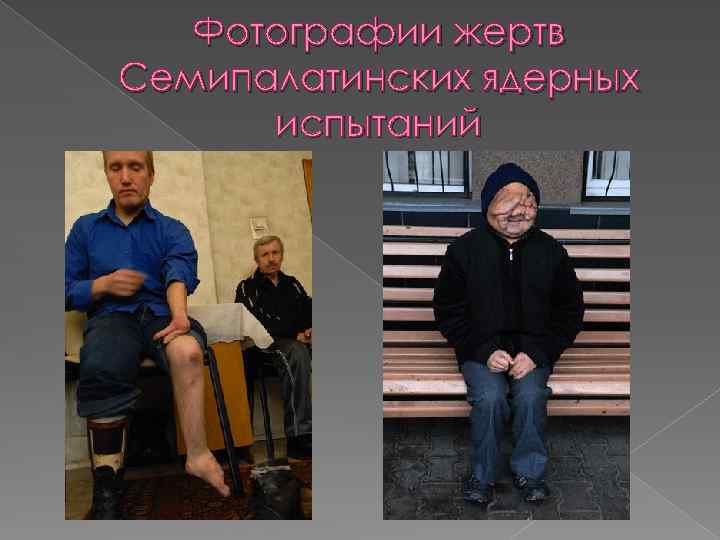 Фотографии жертв Семипалатинских ядерных испытаний 
