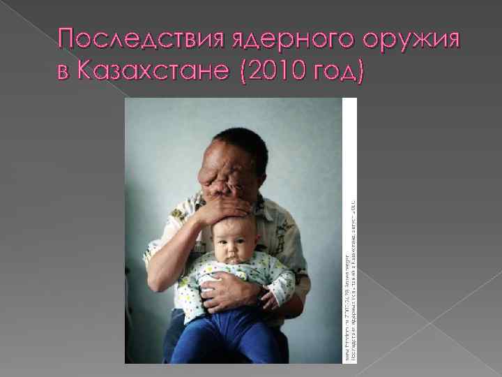 Последствия ядерного оружия в Казахстане (2010 год) 