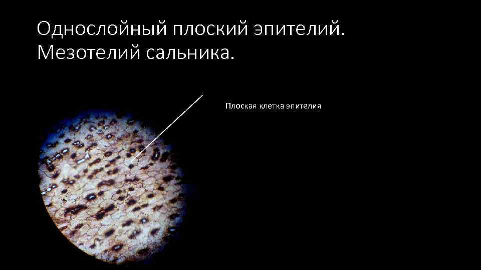 Однослойный плоский эпителий. Мезотелий сальника. Плоская клетка эпителия 