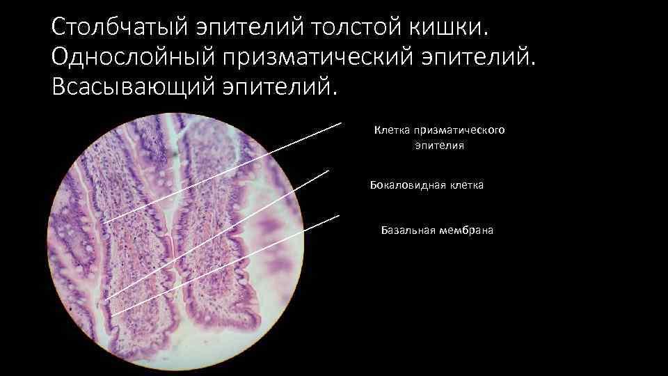 Столбчатый эпителий толстой кишки. Однослойный призматический эпителий. Всасывающий эпителий. Клетка призматического эпителия Бокаловидная клетка