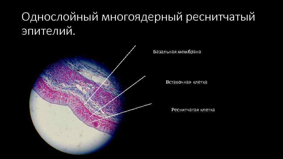 Однослойный многоядерный реснитчатый эпителий. Базальная мембрана Вставочная клетка Реснитчатая клетка 