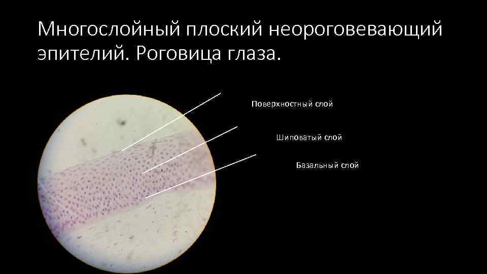Многослойный плоский неороговевающий эпителий. Роговица глаза. Поверхностный слой Шиповатый слой Базальный слой 