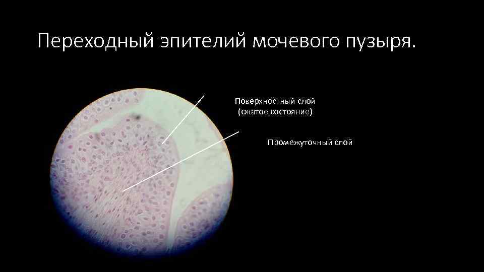 Переходный эпителий мочевого пузыря. Поверхностный слой (сжатое состояние) Промежуточный слой 