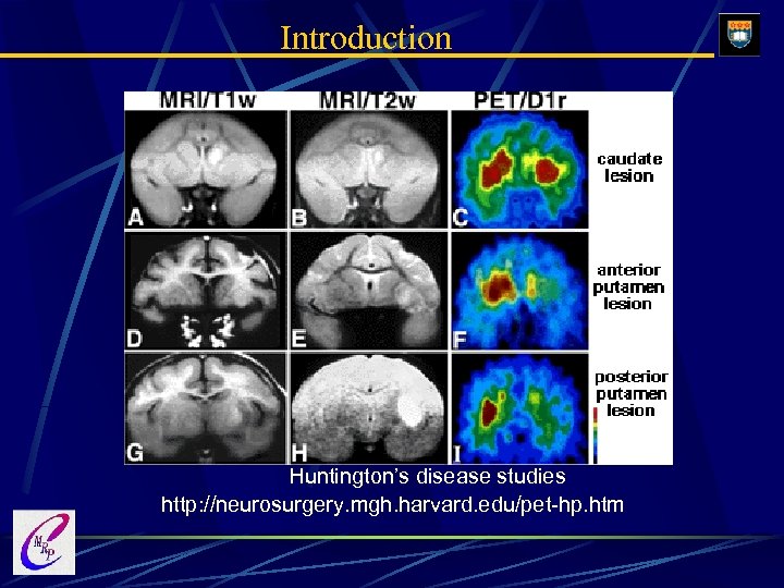 Introduction Huntington’s disease studies http: //neurosurgery. mgh. harvard. edu/pet-hp. htm 