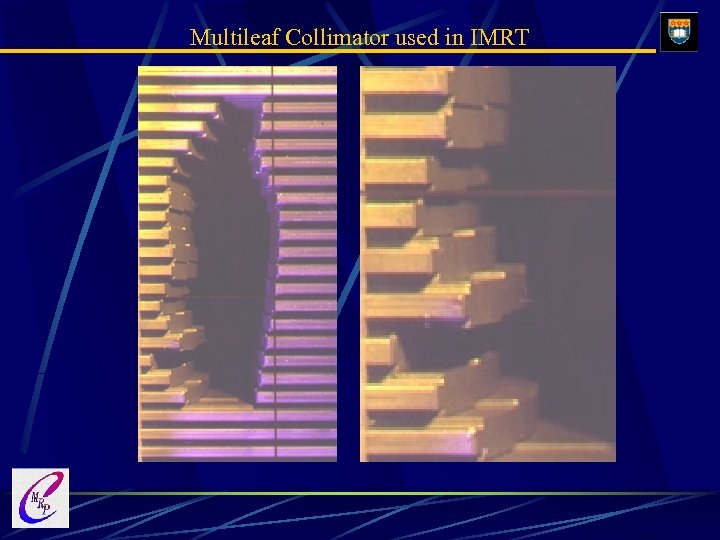 Multileaf Collimator used in IMRT 