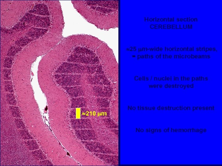 Horizontal section CEREBELLUM 25 m-wide horizontal stripes, = paths of the microbeams Cells /