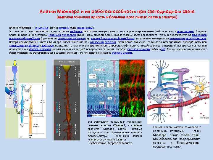 Клетки Мюллера и их работоспособность при светодиодном свете (высокая точечная яркость и большая доза