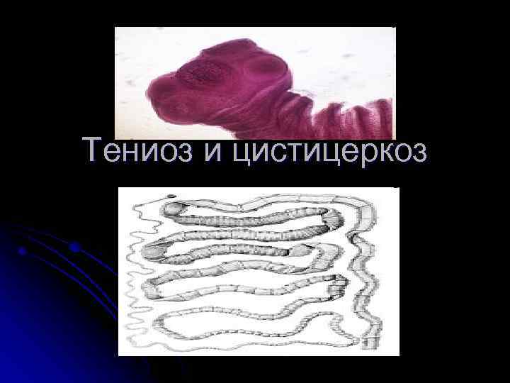 Тениоз и цистицеркоз 