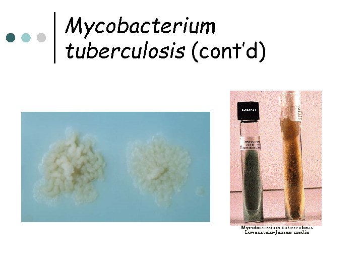 Mycobacterium tuberculosis (cont’d) 