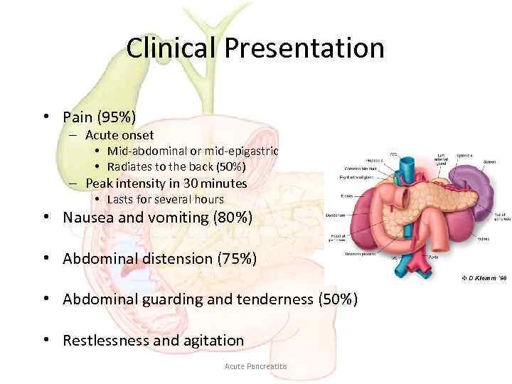 Clinical Presentation • Pain (95%) – Acute onset • Mid-abdominal or mid-epigastric • Radiates