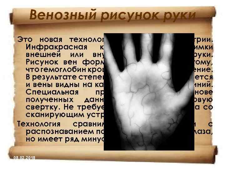 Венозный рисунок руки Это новая технология в сфере биометрии. Инфракрасная камера делает снимки внешней