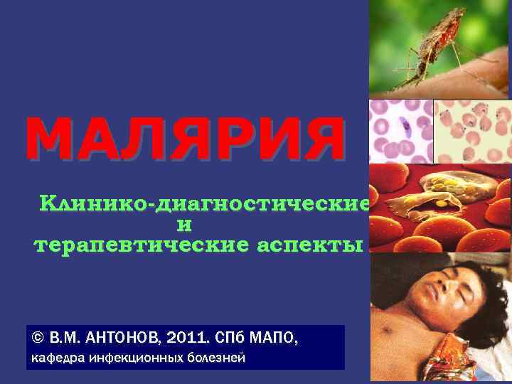 МАЛЯРИЯ Клинико-диагностические и терапевтические аспекты © В. М. АНТОНОВ, 2011. СПб МАПО, кафедра инфекционных