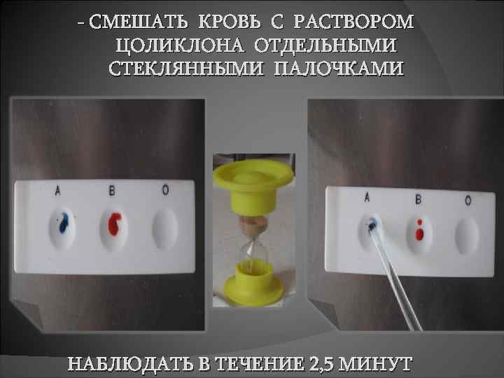 - СМЕШАТЬ КРОВЬ С РАСТВОРОМ ЦОЛИКЛОНА ОТДЕЛЬНЫМИ СТЕКЛЯННЫМИ ПАЛОЧКАМИ НАБЛЮДАТЬ В ТЕЧЕНИЕ 2, 5