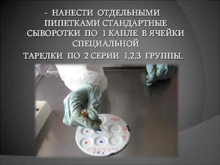  - НАНЕСТИ ОТДЕЛЬНЫМИ ПИПЕТКАМИ СТАНДАРТНЫЕ СЫВОРОТКИ ПО 1 КАПЛЕ В ЯЧЕЙКИ СПЕЦИАЛЬНОЙ ТАРЕЛКИ