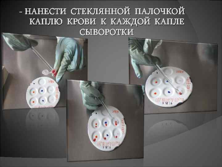 - НАНЕСТИ СТЕКЛЯННОЙ ПАЛОЧКОЙ КАПЛЮ КРОВИ К КАЖДОЙ КАПЛЕ СЫВОРОТКИ 