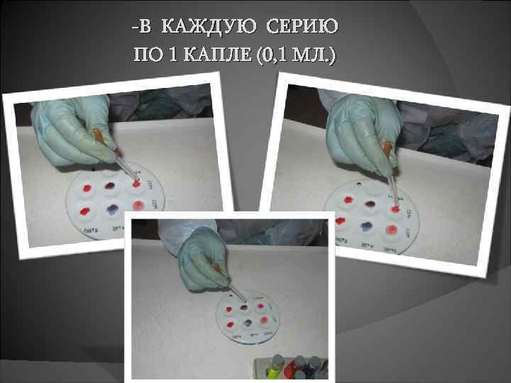 -В КАЖДУЮ СЕРИЮ ПО 1 КАПЛЕ (0, 1 МЛ. ) 