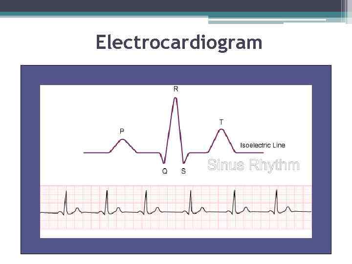 Electrocardiogram 