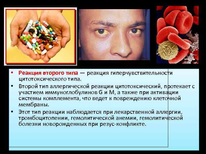  • Реакция второго типа — реакция гиперчувствительности цитотоксического типа. • Второй тип аллергической