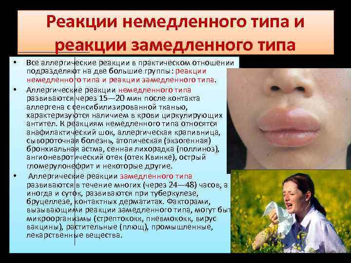 Реакции немедленного типа и реакции замедленного типа • • • Все аллергические реакции в
