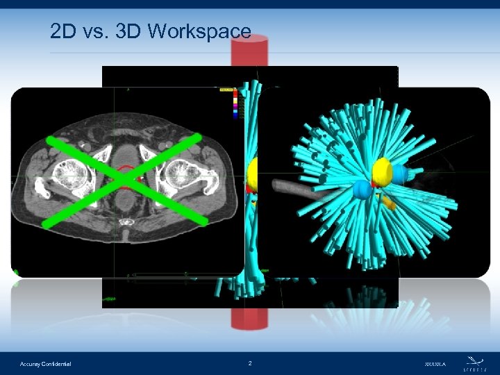 2 D vs. 3 D Workspace Accuray Confidential 2 XXXXX. A 